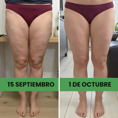 Leggings moldeadoras 3D – efecto push-up y anticelulitis | Compra 1 y llévate 2