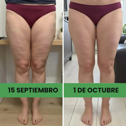Leggings moldeadoras 3D – efecto push-up y anticelulitis | Compra 1 y llévate 2